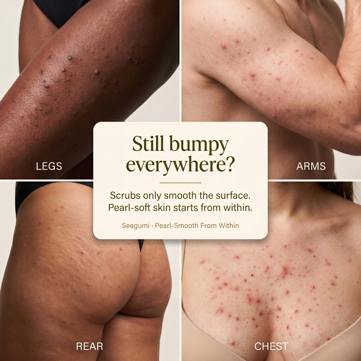 The Clear-Skin Gummy